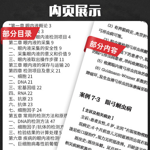 眼内液检测的临床应用 眼科学 医学书籍 2020年7月参考书籍 眼内液检测技术的临床应用 陶勇编著 9787117301367 人民卫生出版社 - 图2
