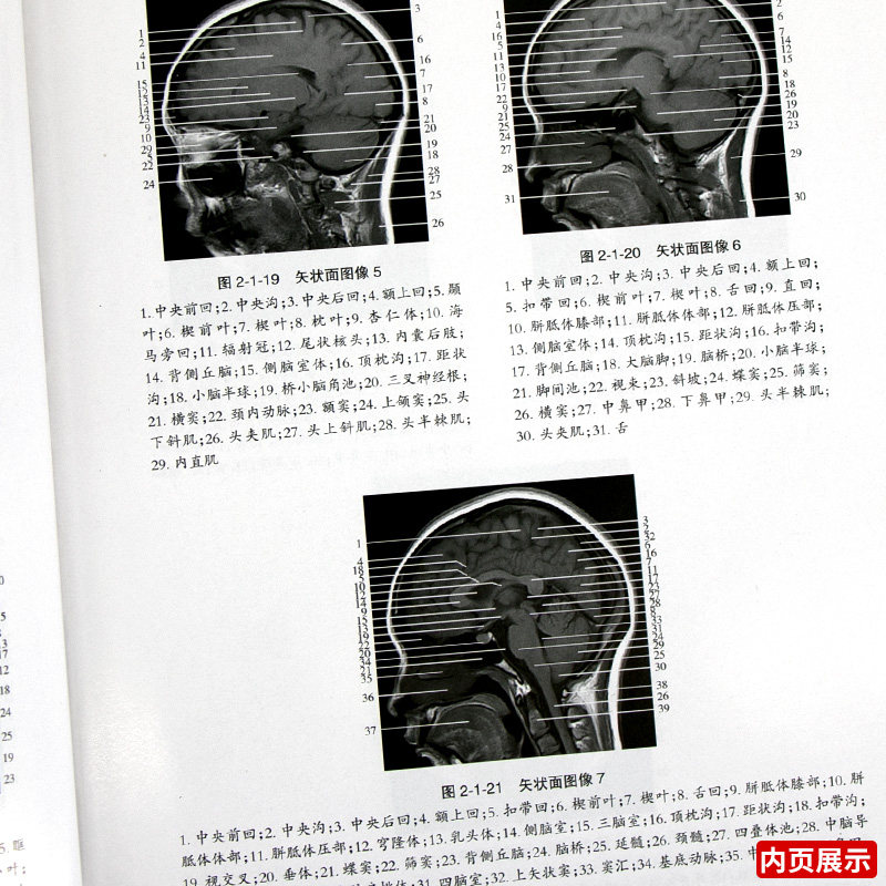 医学影像学读片诊断图谱头颈分册技术用书技士工具书头颈部放射治疗解剖图谱颅脑与肿瘤图谱2017年临床技术影像技师考试解剖图解