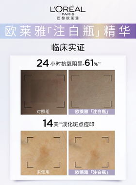 【达人专享】欧莱雅注白瓶美白精华淡斑提亮精华液抗氧化祛斑O