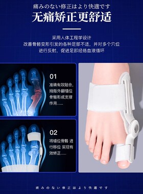日式脚趾矫正器拇指外翻分趾器大母脚指头纠正分离器脚骨突出神器