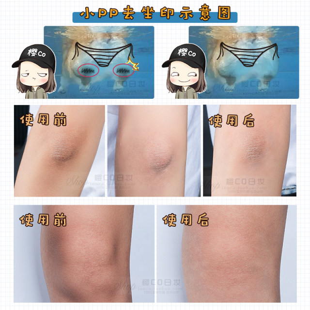 exfoliating buttocks