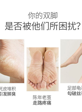 磨脚神器去死皮电动美足工具