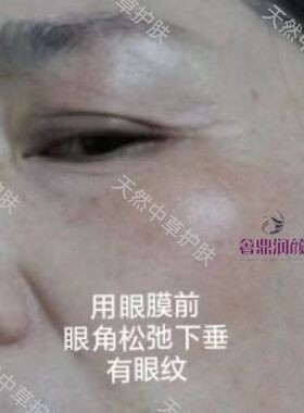 中药眼膜粉抗皱紧致提升眼角淡细纹淡眼袋眼霜眼贴黑眼圈