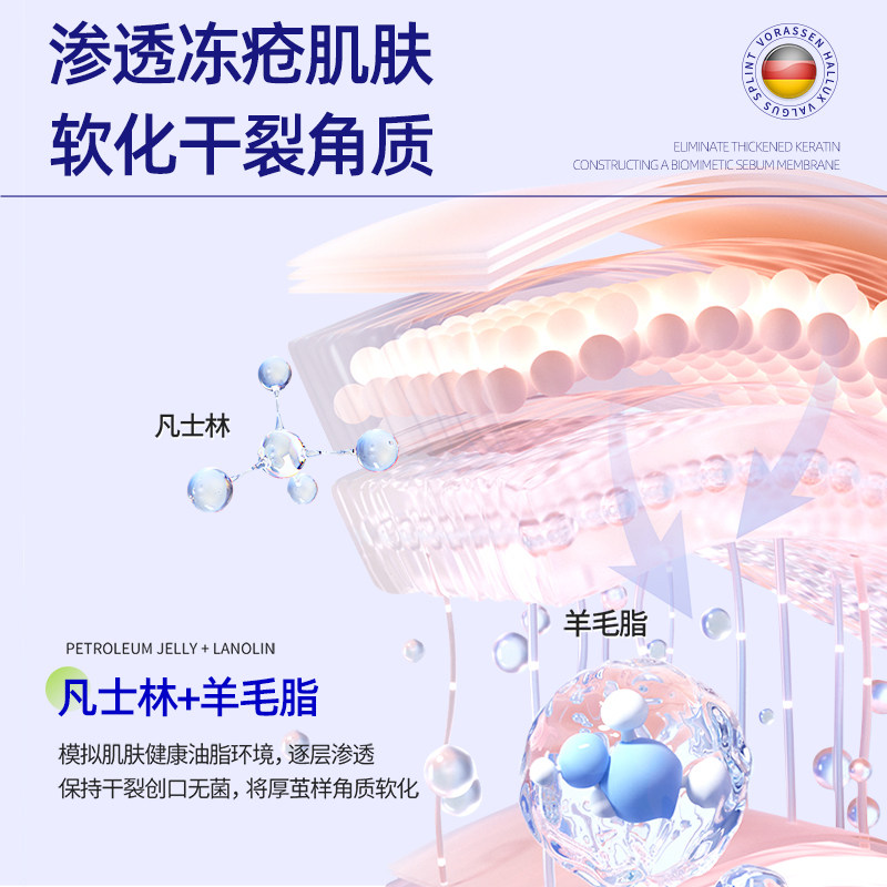 医用冻疮膏冻伤膏儿童预防皲裂脱皮护手足耳朵修护霜正品复非止痒,淘宝优惠券,粉丝福利购,淘宝优惠卷