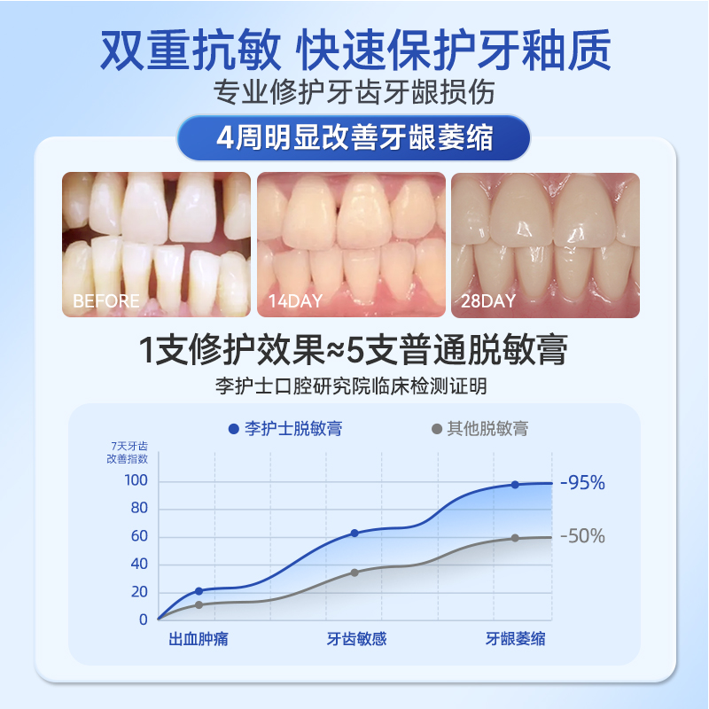 李护士牙齿脱敏剂牙膏牙龈去牙结石去黄洗白防蛀过敏清新口气美白 - 图2