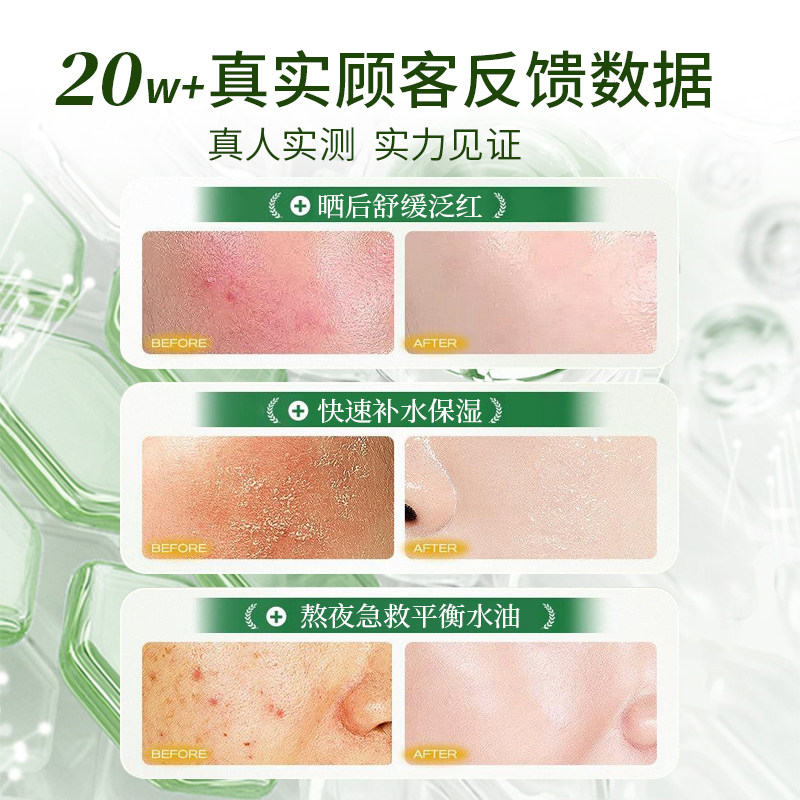 Hydrating and moisturizing after-sun care aloe vera gel