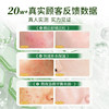 Hydrating and moisturizing after-sun care aloe vera gel