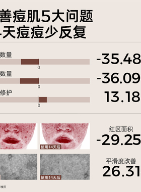 C咖油痘肌清痘水修护敏感肌35ml