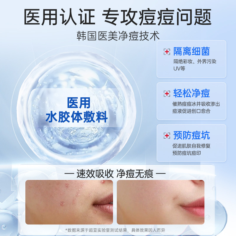 医用痘痘贴人工皮修复消炎吸脓祛痘印隐形薄遮瑕可上妆水胶体72贴,淘宝优惠券,粉丝福利购,淘宝优惠卷