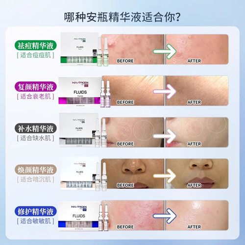 韩国进口韩美特丽珍MTS微晶针导入精华原液水光滚针安瓶补水保湿 - 图0