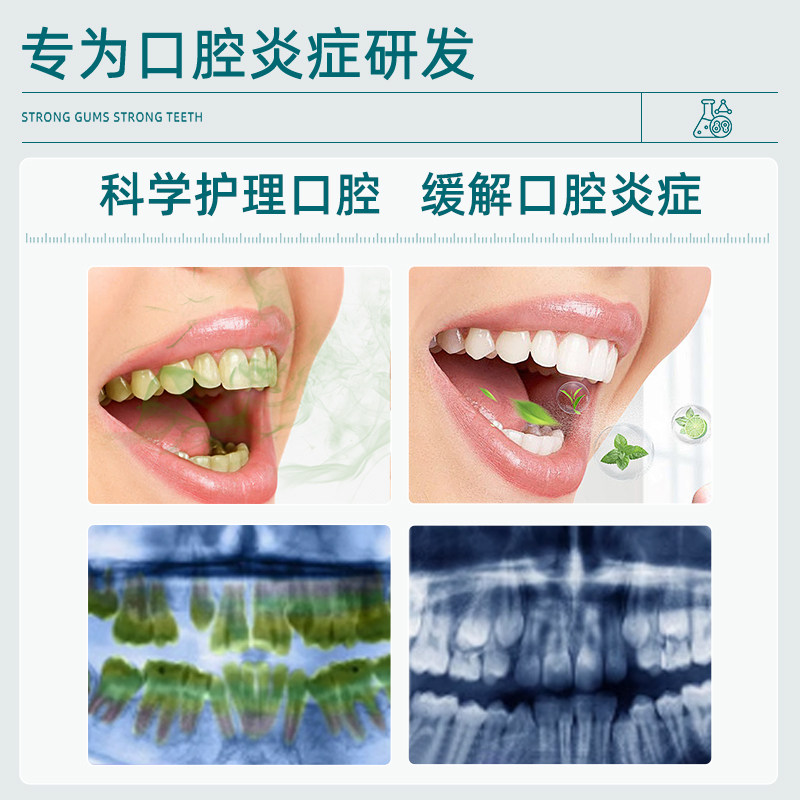 漱口水改善牙龈持久留香便携一次性小包装医炎专用牙周炎,淘宝优惠券,粉丝福利购,淘宝优惠卷