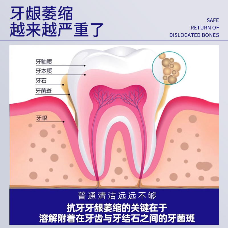 牙龈萎缩修复再生专用成人医用口腔牙齿松动固齿脱敏牙膏治牙周炎 - 图0