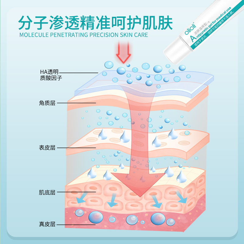 olioli皮肤湿痒型皮炎湿疹瘙痒不适医用凝胶手上手指手背身体乳膏 - 图2