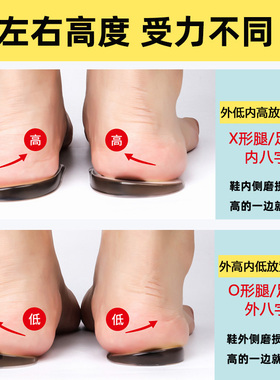 X型腿矫正鞋垫O形腿矫形神器直腿