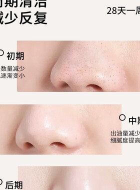 竹炭吸黑头面膜清洁粉刺撕拉泥膜祛导出液收缩毛孔涂抹式黑头面膜
