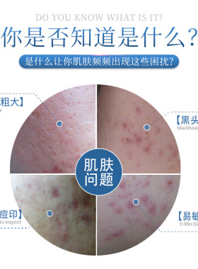 津泊兰滋养清爽祛痘凝胶修护护肤