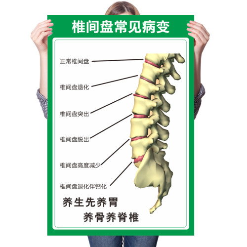 人体椎间盘常见病变颈椎 脊椎全息图 骨骼挂图医院腰椎间盘突墙贴 - 图3