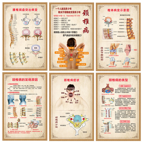 脊椎健康速查表人体脊柱相纸疾病示意图中医养生医学健康挂图海报 - 图1