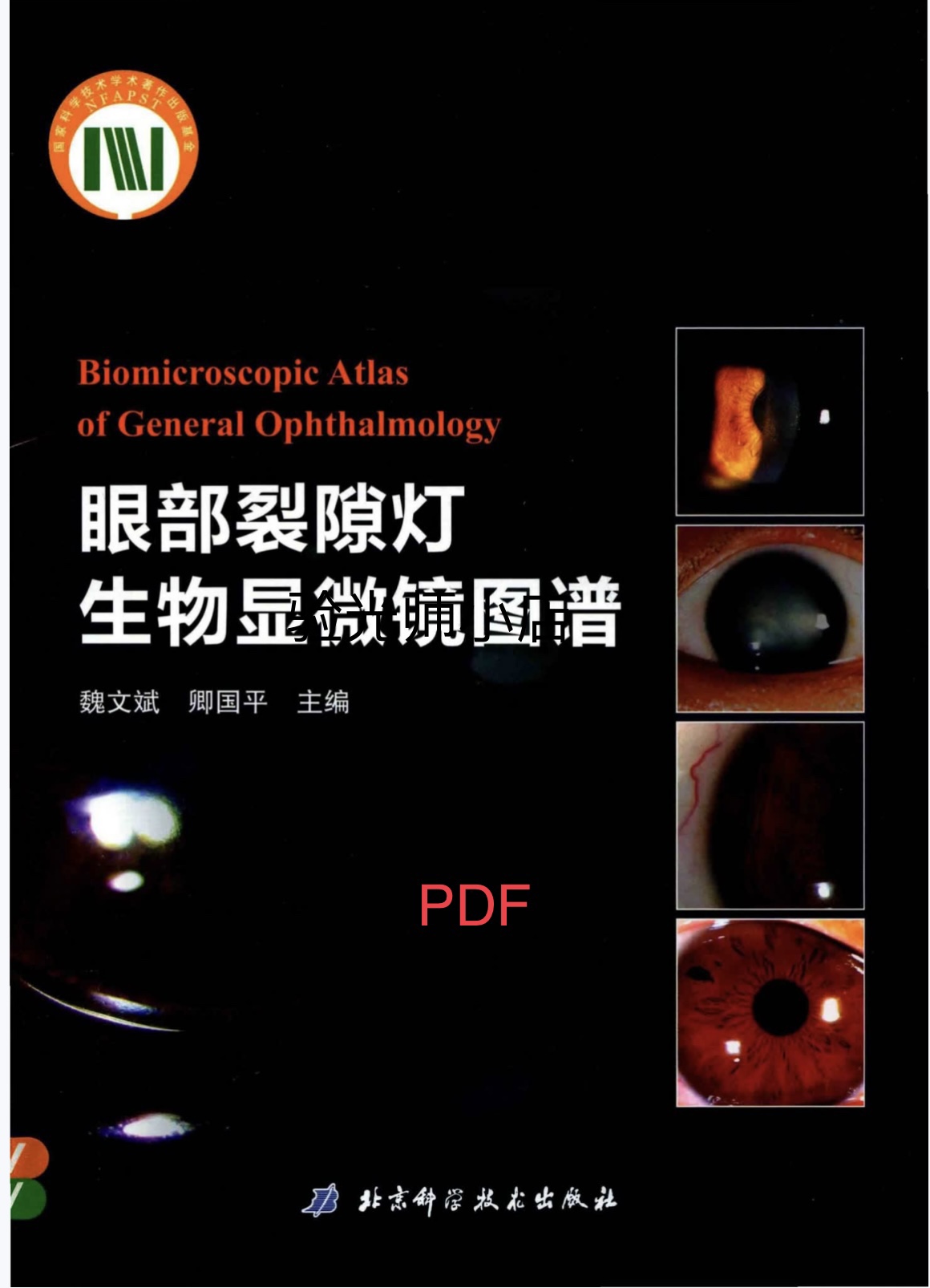 眼视光裂隙灯使用 眼部裂隙灯生物显微镜图谱 眼视光文献代找 - 图0