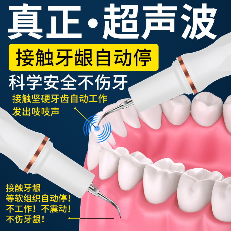 胖猫超声波洁牙器洗牙渍牙结石去除神器大功率洗牙器家用清理工具 - 图0