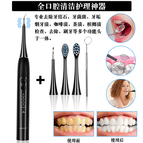 胖猫成人洗牙神器牙结石去除器两用洁牙器学生电动牙刷清理烟渍家 - 图1