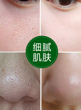 毛孔收细精华液快速紧致控油保湿
