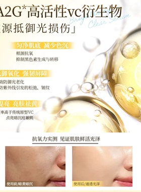 日本倩诗丽VC肌底精华液亮白