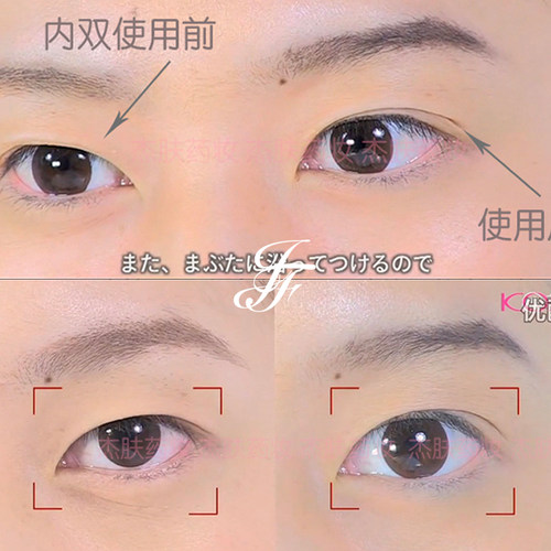 日本蔻吉KOJI双眼皮胶水 隐形定型eyetalk持久速干透明自然防过敏 - 图2
