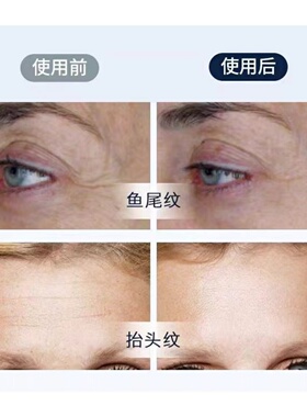 法国溪莱sylaine跟细纹说拜拜