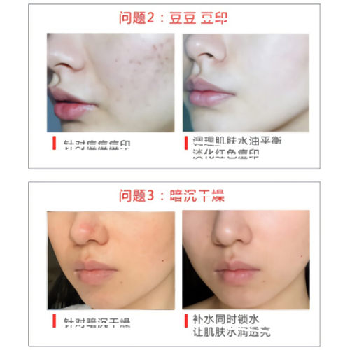 日本思科研小红帽色修精华液单支10ml - 图1