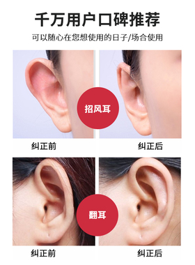 招风耳矫正器-进口硅凝胶矫形贴