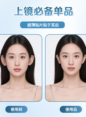 婴幼儿招风耳矫正器耳朵支撑改善神器儿童成人耳廓定型舒适隐形款