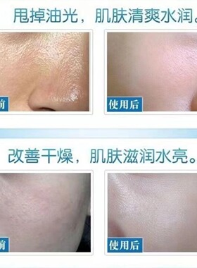 玻尿酸原液次抛补水保湿提亮肤色