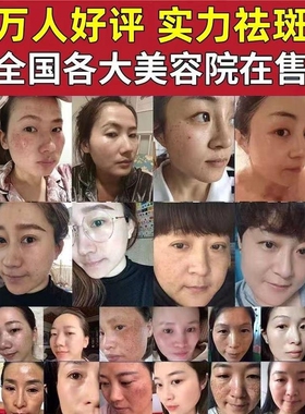 媄怡神专用30ml臭臭水精华水