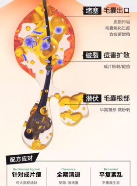 衡美肤祛痘粉刺闭口套装组合正品