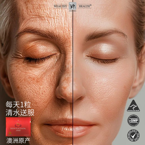 Wealthy health澳洲富康鹿胎素鹿胎盘素胶囊直邮发货正品授权经销 - 图2