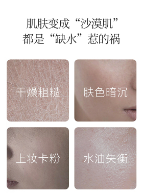 2瓶220元5瓶305蔻琦精灵粒子霜补水保湿修复淡化妊娠纹红血丝面霜