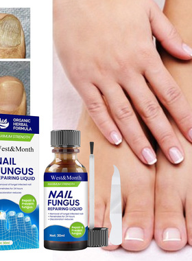 Nail repair solution 指甲护理液营养液祛除灰指甲抑菌液30ml