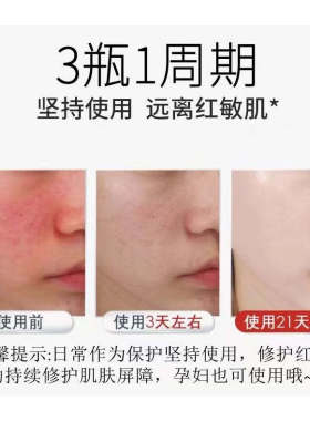 贝莲薇表皮修复凝胶皮肤点阵激光纹身后点痣祛斑敏感肌多肽冰晶