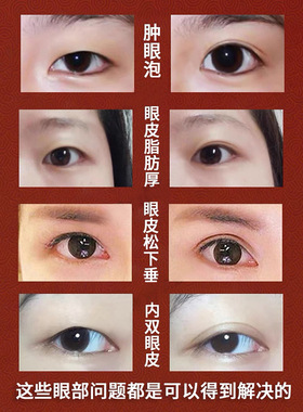 佰草世家眼霜去浮肿提拉紧致