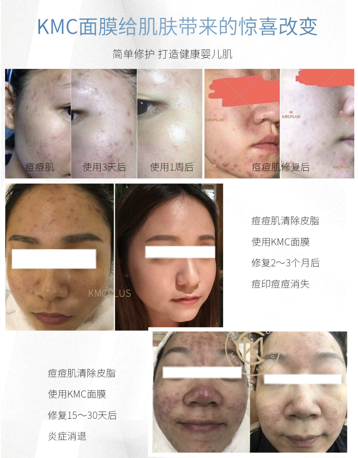 kmcplus水光面膜补水保湿镇定舒缓修复抗衰提亮孕妇无菌敏感可用,淘宝优惠券,粉丝福利购,淘宝优惠卷