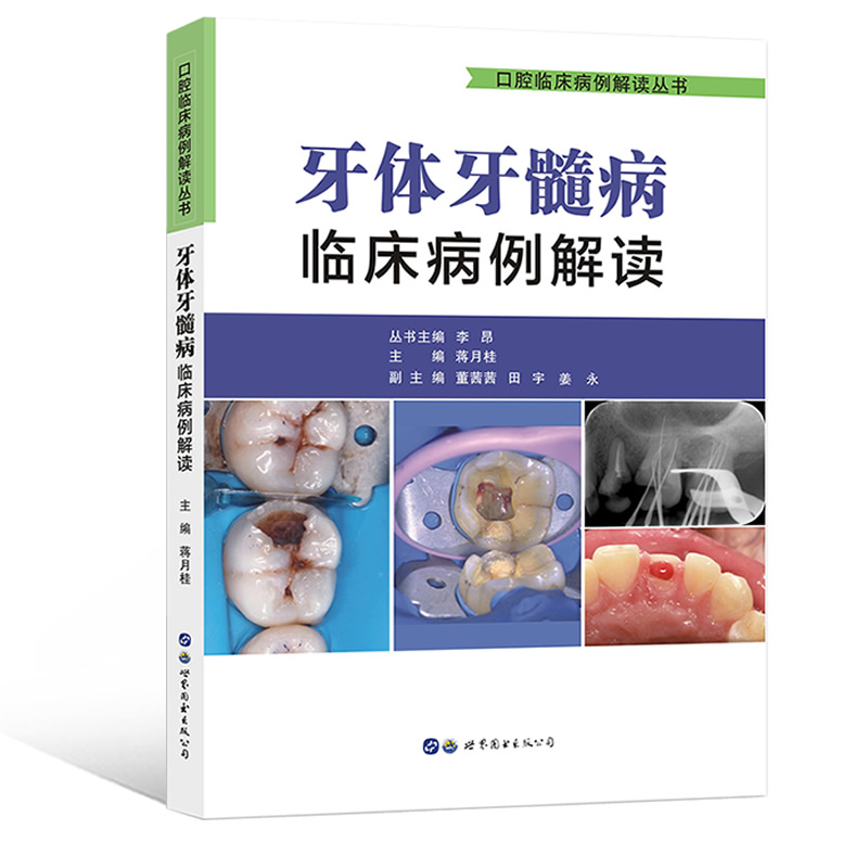 正版包邮 牙体牙髓病临床病例解读 口腔临床病例解读丛书 李昂,蒋月桂主编 牙体牙髓病学口腔内科全科医生医学书籍 世界图书出版 - 图2