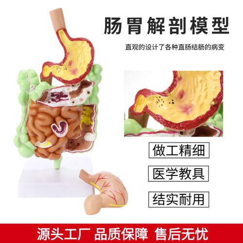 人体大肠病理模型 肠胃解剖模型 大肠 盲肠 直肠 十二指肠模型 - 图1