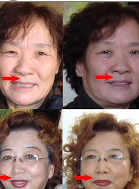 草本嘴唇皱纹精油 唇纹人中纹人中精华液眼纹抬头纹川字纹周口纹
