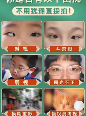草本斜视修复 改善斗鸡眼内斜外斜视眼睛不聚焦重影眼红眼疲劳