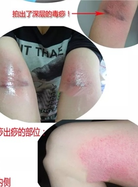 拍痧板硅胶经络拍打拍拍棒肩颈敲打按摩健身锤腿拍养生专用2只装