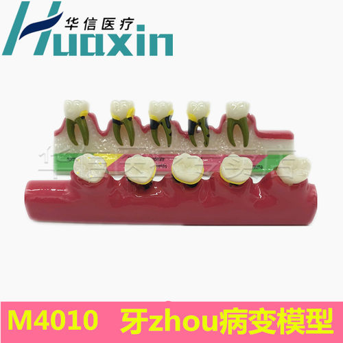 牙齿模型口腔教学假牙模型正畸模牙科种植修复练习乳牙牙齿模型 - 图1