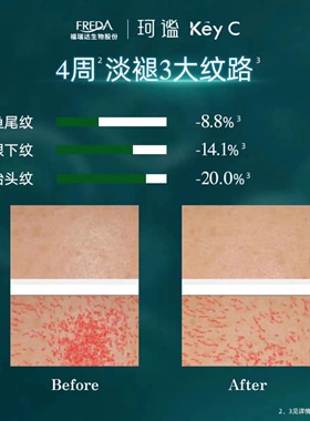 福瑞达KeyC珂谧重组胶原蛋白
