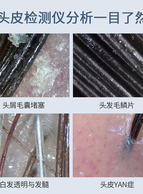 300万像素放大600兼容毛囊检测