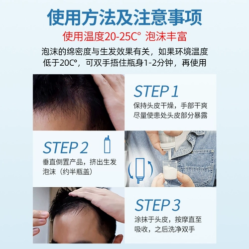 蔓迪 Миноксидиловая пена агент 60 г мужской выпадение волос Alopecia areata пенопласта второго поколения в флагманском магазине подлинный продукт